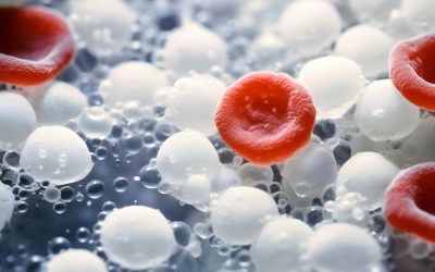 Neutrófilos bastonetes e desvio à esquerda: como a detecção automatizada antecipa a suspeita de sepse