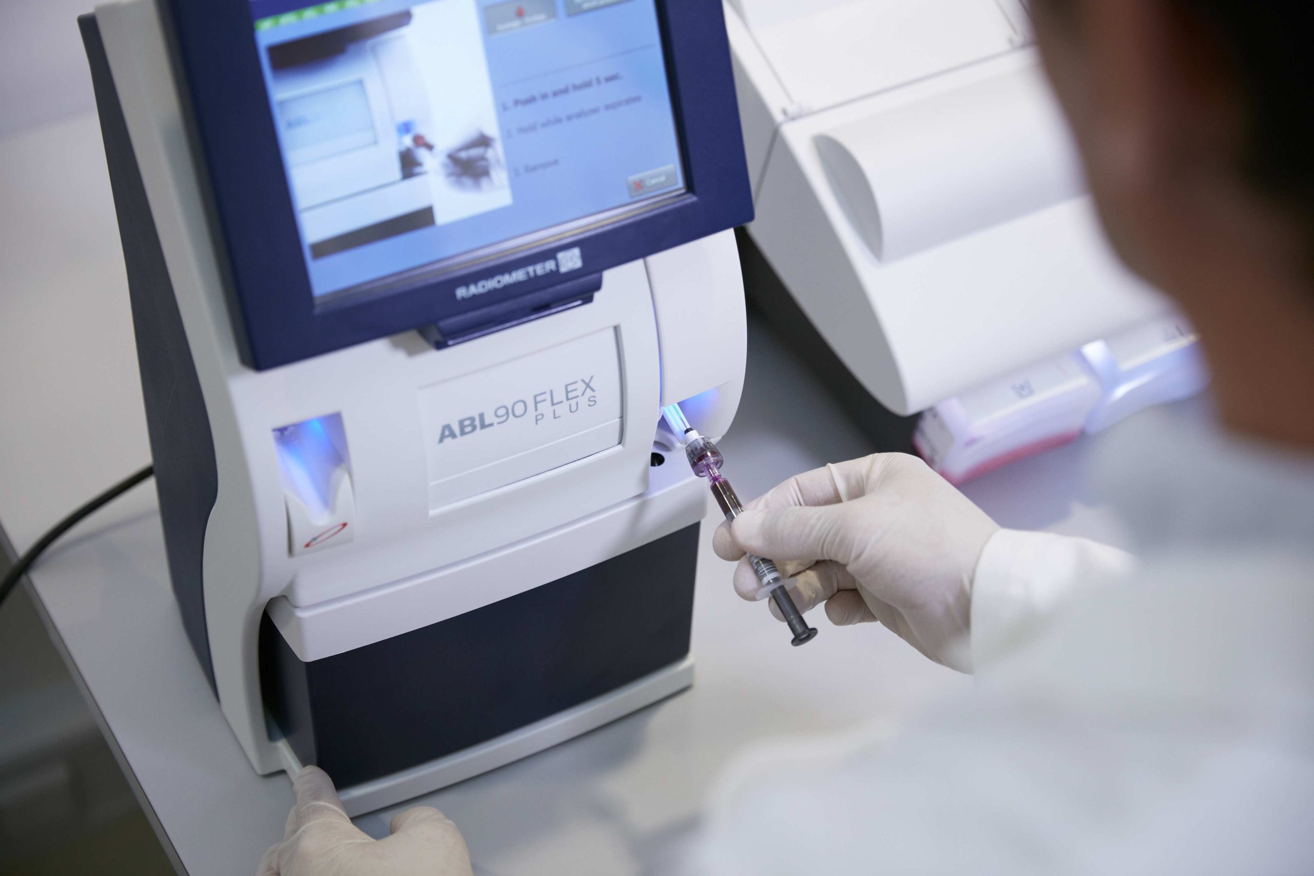 ABL90 Flex e o futuro da medicina diagnostica
